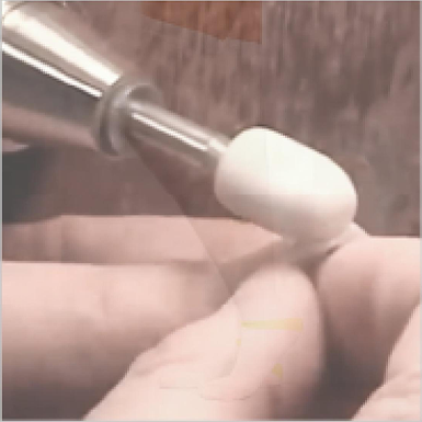 使用纯羊毛抛光头进行抛光义眼片表面，使得眼片更加光滑。